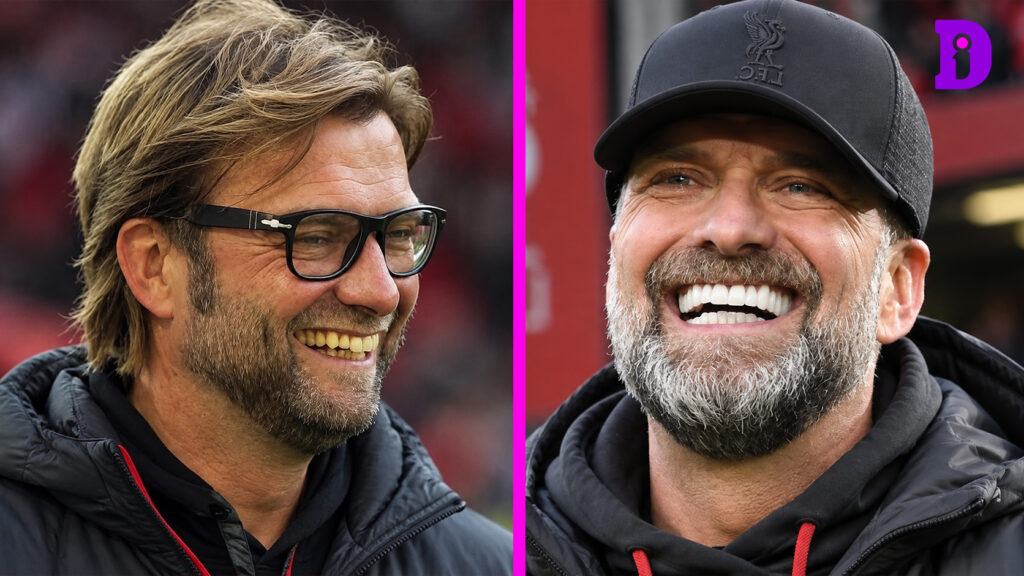 Jurgen Klopp Teeth
