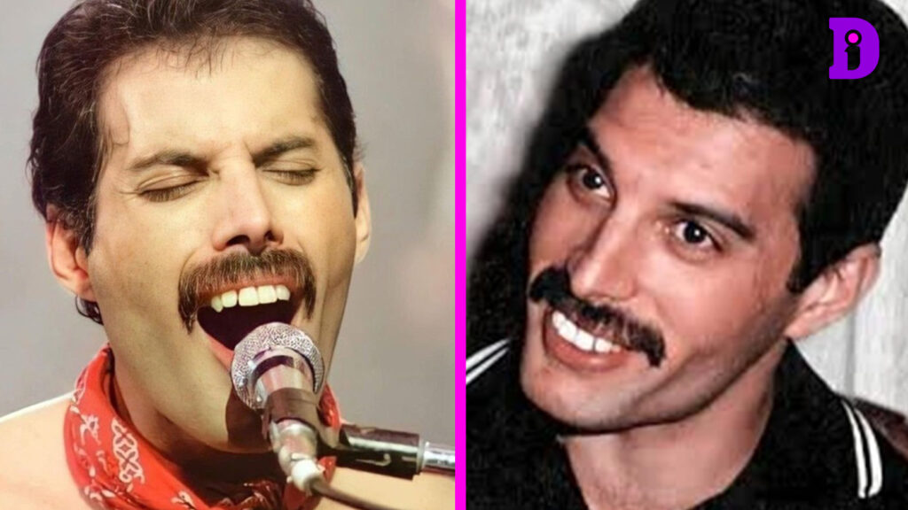 Freddie Mercury Teeth