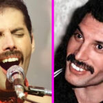Freddie Mercury Teeth